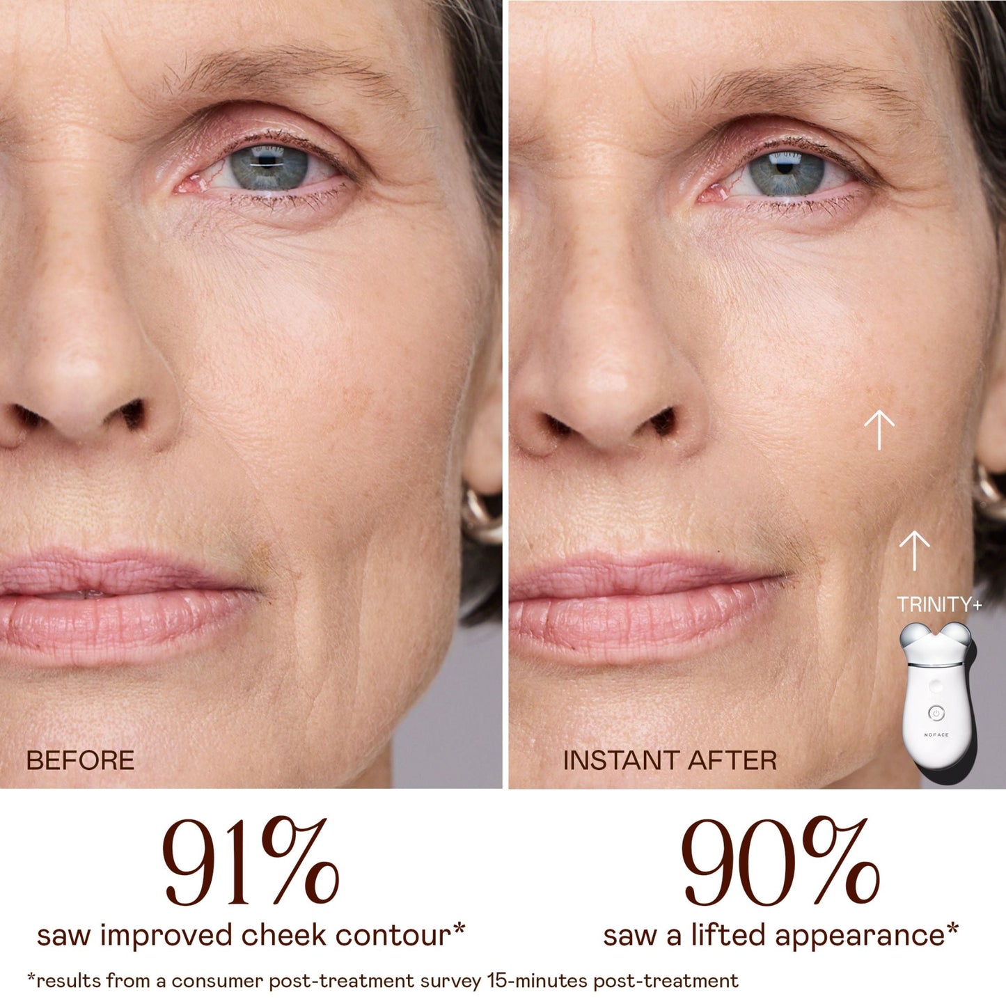 Lifting & Smoothing Lip & Eye Microcurrent Attachment