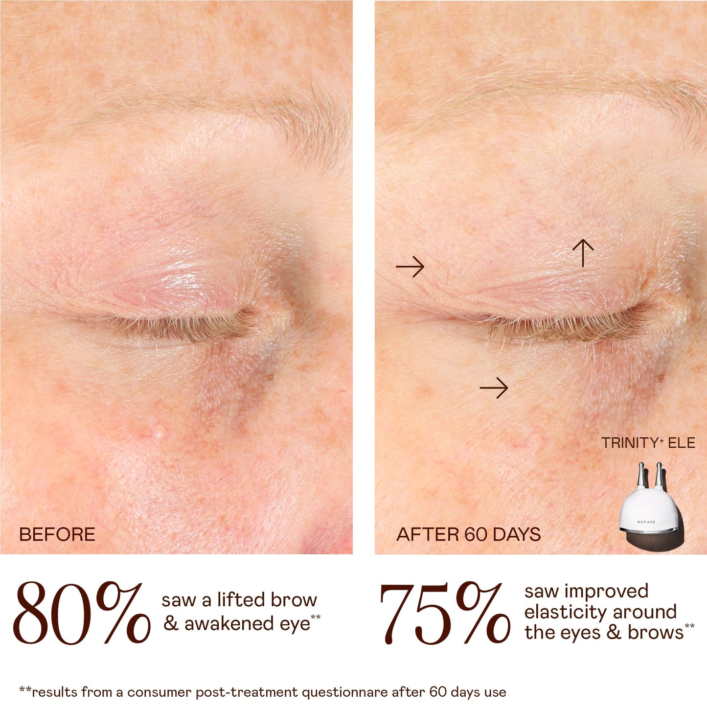 Lifting & Smoothing Lip & Eye Microcurrent Attachment