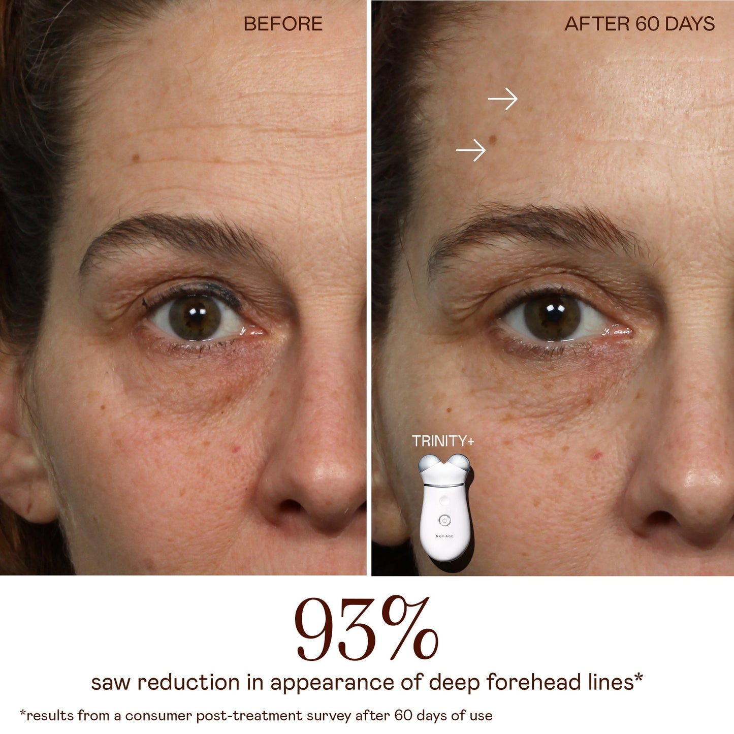 Starter Kit - Pro-Longevity Microcurrent Facial Lifting Device