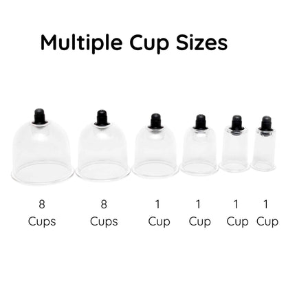 MMT POLY CUPS™ Pump Gun Cupping Set