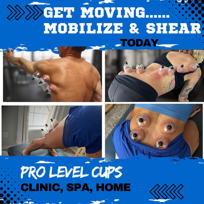 MMT POLY CUPS™ Pump Gun Cupping Set