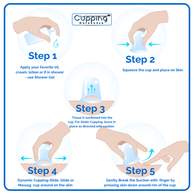 Cupping Warehouse Ultimate Chinese 36 Cup Set (20 Poly CupsTM Stronger PlasticPolycarbonate, 8 Supreme Deep PRO 6065 & 8 Grip PRO 6570 Silicone Cupping Therapy Sets
